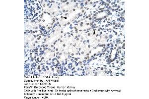 Rabbit Anti-SURF6 Antibody  Paraffin Embedded Tissue: Human Kidney Cellular Data: Epithelial cells of renal tubule Antibody Concentration: 4. (SURF6 antibody  (Middle Region))
