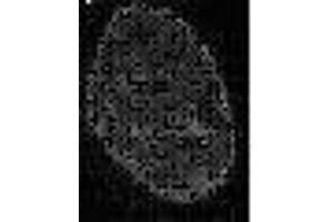 Immunofluorescence (IF) image for anti-Chromobox Homolog 3 (CBX3) (C-Term) antibody (ABIN2452035) (CBX3 antibody  (C-Term))