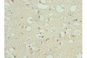 Immunohistochemistry of paraffin-embedded human brain tissue using ABIN7165737 at dilution of 1:100 (FAIM2 antibody  (AA 1-105))
