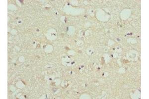 Immunohistochemistry of paraffin-embedded human brain tissue using ABIN7165737 at dilution of 1:100 (FAIM2 antibody  (AA 1-105))