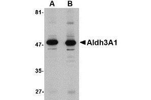Western blot analysis of Aldh3A1 in human stomach lysate with AP30043PU-N Aldh3A1 antibody at (A) 1 and (B) 2 μg/ml.