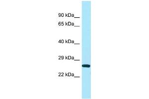 WB Suggested Anti-UQCC Antibody Titration: 1. (Ubiquinol-Cytochrome C Reductase Complex Chaperone (UQCC) (N-Term) antibody)