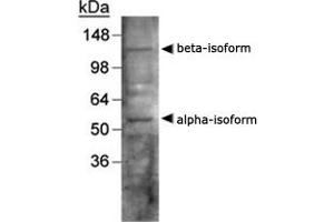 Western blot analysis of LXR in human liver using NR1H3/NR1H2 polyclonal antibody . (NR1H3 antibody  (AA 50-150))