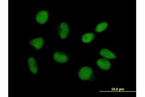 Immunofluorescence of purified MaxPab antibody to CGI-09 on HeLa cell.