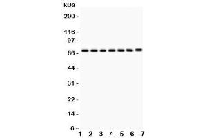 Western blot testing of FOXO3A antibody and Lane 1:  rat thymus (FOXO3 antibody  (AA 471-673))
