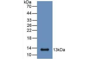Detection of Recombinant S100A6, Mouse using Monoclonal Antibody to S100 Calcium Binding Protein A6 (S100A6) (S100A6 antibody  (AA 1-89))