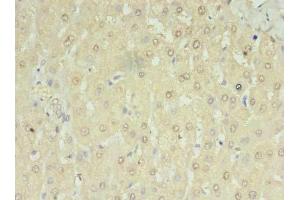Immunohistochemistry of paraffin-embedded human liver tissue using ABIN7168454 at dilution of 1:100 (RNMTL1 antibody  (AA 41-205))