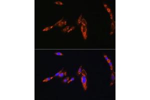 Immunofluorescence analysis of NIH/3T3 cells using A Rabbit pAb (ABIN6129944, ABIN6137377, ABIN6137378 and ABIN6224448) at dilution of 1:100. (AVPR1A antibody  (AA 349-418))