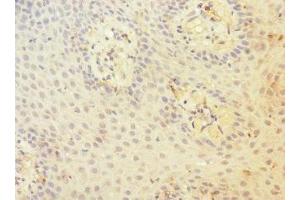 Immunohistochemistry of paraffin-embedded human tonsil tissue using ABIN7147204 at dilution of 1:100 (CD97 antibody  (AA 240-435))