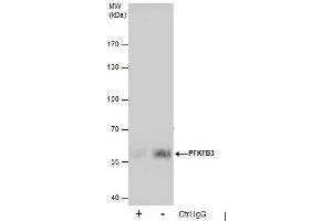 IP Image Immunoprecipitation of PFKFB3 protein from A431 whole cell extracts using 5 μg of PFKFB3 antibody [C3], C-term, Western blot analysis was performed using PFKFB3 antibody [C3], C-term, EasyBlot anti-Rabbit IgG  was used as a secondary reagent. (PFKFB3 antibody  (C-Term))