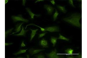 Immunofluorescence of monoclonal antibody to KLK2 on HeLa cell. (Kallikrein 2 antibody  (AA 1-262))