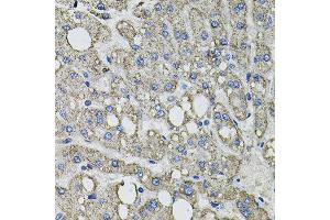 Immunohistochemistry of paraffin-embedded human liver injury using GFPT1 antibody at dilution of 1:100 (x40 lens). (GFPT1 antibody)