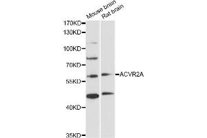 Western blot analysis of extracts of various cell lines, using ACVR2A antibody (ABIN5971030) at 1/1000 dilution. (ACVR2A antibody)