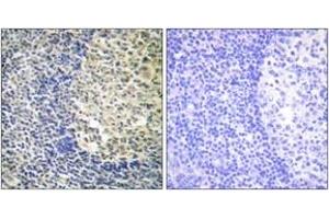 Immunohistochemistry analysis of paraffin-embedded human tonsil, using p47 phox (Phospho-Ser370) Antibody. (NCF1 antibody  (pSer370))