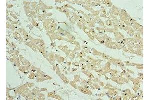 Immunohistochemistry of paraffin-embedded human heart tissue using ABIN7144071 at dilution of 1:100 (APC1 antibody  (AA 1-185))