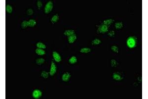 Immunofluorescent analysis of A549 cells using ABIN7150707 at dilution of 1:100 and Alexa Fluor 488-congugated AffiniPure Goat Anti-Rabbit IgG(H+L) (MAP2K3 antibody  (AA 1-347))
