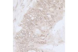 Immunohistochemistry (IHC) image for anti-Nucleoporin 35kDa (NUP35) (AA 276-376) antibody (ABIN7454783)