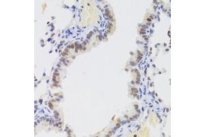 Immunohistochemistry of paraffin-embedded mouse lung using NASP Antibody. (NASP antibody  (AA 180-449))