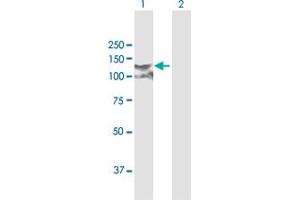 Western Blot analysis of CDH3 expression in transfected 293T cell line by CDH3 MaxPab polyclonal antibody. (P-Cadherin antibody  (AA 1-829))