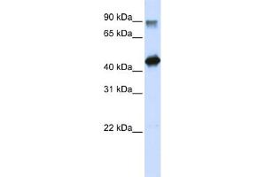 WB Suggested Anti-HMG20A Antibody Titration:  0. (HMG20A antibody  (N-Term))