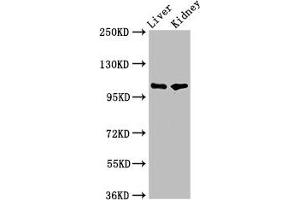 Western Blot Positive WB detected in: Rat liver tissue, Mouse kidney tissue All lanes: PEAR1 antibody at 5.