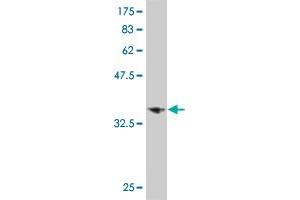 Western Blot detection against Immunogen (35. (LHX6 antibody  (AA 274-363))