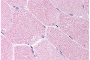 Human Skeletal Muscle (formalin-fixed, paraffin-embedded) stained with BARD1 antibody ABIN214634 at 10 ug/ml followed by biotinylated goat anti-rabbit IgG secondary antibody ABIN481713, alkaline phosphatase-streptavidin and chromogen. (BARD1 antibody  (AA 108-124))