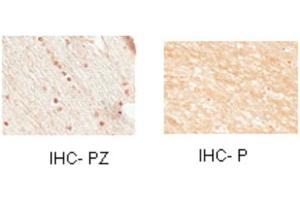 Sample Type:  Human Optic Nerve and Spinal CordCellular Target: Oligoden Drocyte Lineage CellsPrimary   Dilution:  IHC-PZ 1:500, IHC-P 1:1000 (Nkx2-2 antibody  (N-Term))