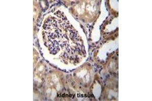 AKR1C3 Antibody (Center) immunohistochemistry analysis in formalin fixed and paraffin embedded human kidney tissue followed by peroxidase conjugation of the secondary antibody and DAB staining. (AKR1C3 antibody  (Middle Region))