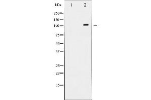 Western blot analysis of NMDAR1 expression in Jurkat whole cell lysates,The lane on the left is treated with the antigen-specific peptide. (GRIN1/NMDAR1 antibody  (C-Term))