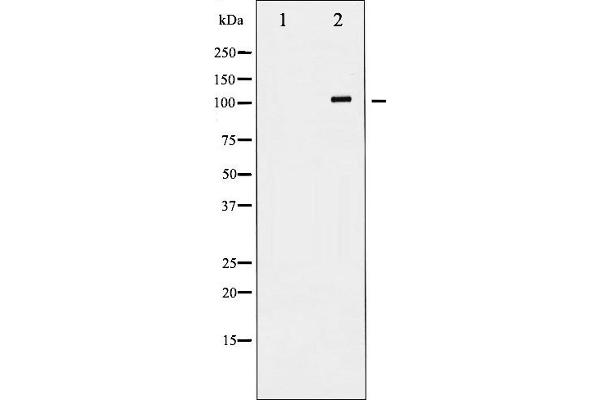 GRIN1/NMDAR1 antibody  (C-Term)