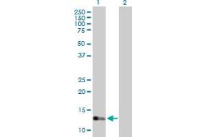 Western Blot analysis of IFT20 expression in transfected 293T cell line by IFT20 MaxPab polyclonal antibody. (IFT20 antibody  (AA 1-148))