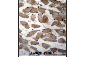 ACTN3 Antibody (Center) (ABIN656261 and ABIN2845575) immunohistochemistry analysis in formalin fixed and paraffin embedded human skeletal muscle followed by peroxidase conjugation of the secondary antibody and DAB staining. (ACTN3 antibody  (AA 409-437))