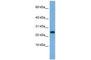 Image no. 1 for anti-Ankyrin Repeat Domain 39 (ANKRD39) (AA 35-84) antibody (ABIN6745692) (ANKRD39 antibody  (AA 35-84))