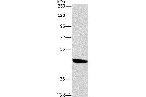 Western blot analysis of A172 cell, using BRS3 Polyclonal Antibody at dilution of 1:500 (BRS3 antibody)