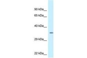 Image no. 1 for anti-Kv Channel Interacting Protein 2 (KCNIP2) (AA 204-253) antibody (ABIN6747467) (KCNIP2 antibody  (AA 204-253))