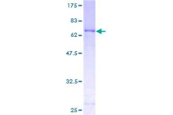 PDK2 Protein (AA 1-407) (GST tag)