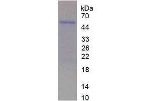 SDS-PAGE analysis of Rat WISP2 Protein.