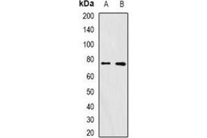 Western blot analysis of FURIN expression in A375 (A), mouse ovary (B) whole cell lysates. (FURIN antibody)
