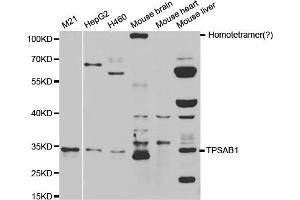 Western blot analysis of extracts of various cell lines, using TPSAB1 antibody. (TPSAB1 antibody)