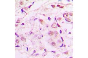 Immunohistochemistry (IHC) image for anti-Myocyte Enhancer Factor 2A (MEF2A) (pSer319) antibody (ABIN7299348)