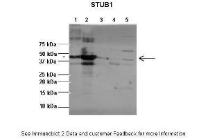 Lanes:   1:1ug insoluble STUB1 protein, 2:1ug soluble STUB1 protein, 3:1ug EPM2A protein, 4:1ug insoluble PPP1R3C protein, 5:1ug soluble PPP1R3C protein  Primary Antibody Dilution:   1:2500  Secondary Antibody:   Anti-rabbit-AP  Secondary Antibody Dilution:   1:20,000  Gene Name:   STUB1  Submitted by:   Pedro Castanheira, Biocant (STUB1 antibody  (C-Term))