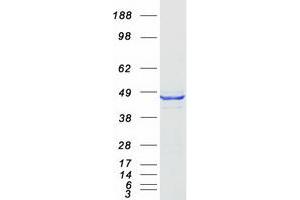 Chromosome 16 Open Reading Frame 70 (C16orf70) protein (Myc-DYKDDDDK Tag)