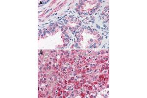 Immunohistochemical staining of formalin-fixed, paraffin-embedded human prostate (A) and human adrenal gland (B) tissue after heat-induced antigen retrieval. (CCKAR antibody  (Internal Region))