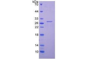 SDS-PAGE of Protein Standard from the Kit  (Highly purified E. (TNNI3 ELISA Kit)