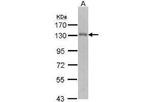 WB Image Sample (30 ug of whole cell lysate) A: Molt-4 , 7. (USP15 antibody  (C-Term))