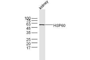 Mouse kidney lysates probed with Rabbit Anti-HSP60 Polyclonal Antibody  at 1:300 overnight at 4˚C. (HSPD1 antibody  (AA 501-573))