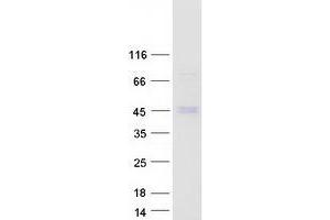 MACROD2 Protein (Transcript Variant 2) (Myc-DYKDDDDK Tag)