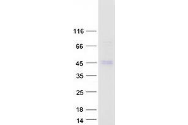 MACROD2 Protein (Transcript Variant 2) (Myc-DYKDDDDK Tag)