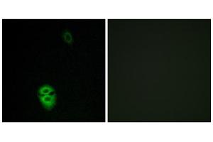 Immunofluorescence analysis of Jurkat cells, using OR4K17 antibody.